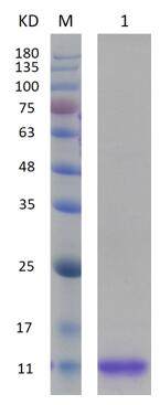 15% SDS-PAGE analysis profiles of purified human TIGIT (CBB stained).